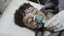 Un niño recibe tratamiento médico tras un supuesto ataque químico contra la localidad de Jan Shijún, en Siria, hoy, 4 de abril de 2017.EFE/STRINGER
