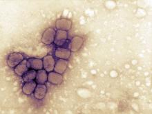 The smallpox virus was said to be eradicated in 1980. Photo: Getty Images.
